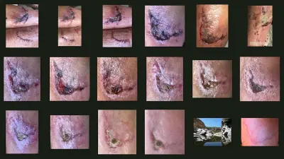 Photo of Lacerations